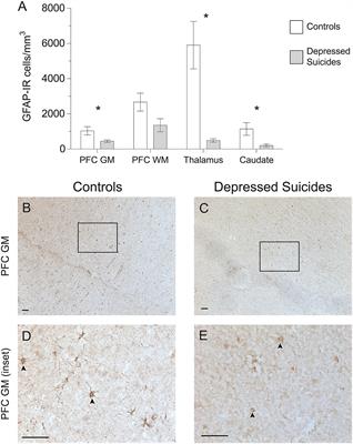 Widespread Decrease of Cerebral Vimentin-Immunoreactive Astrocytes in Depressed Suicides
